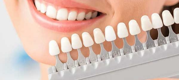 Dental Bridges in Pitampura