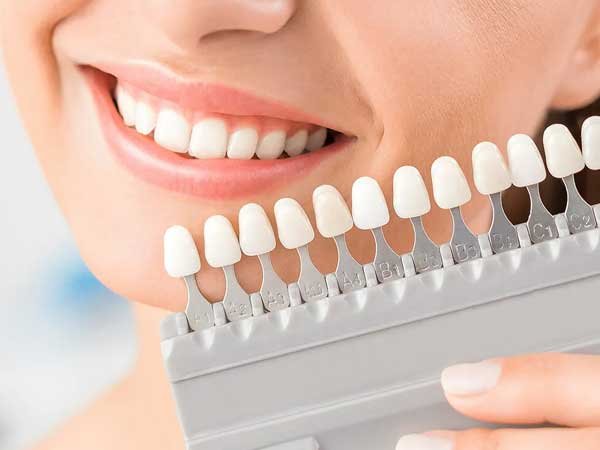 Dental Bridges in Pitampura