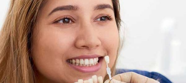 dental veneers in pitampura